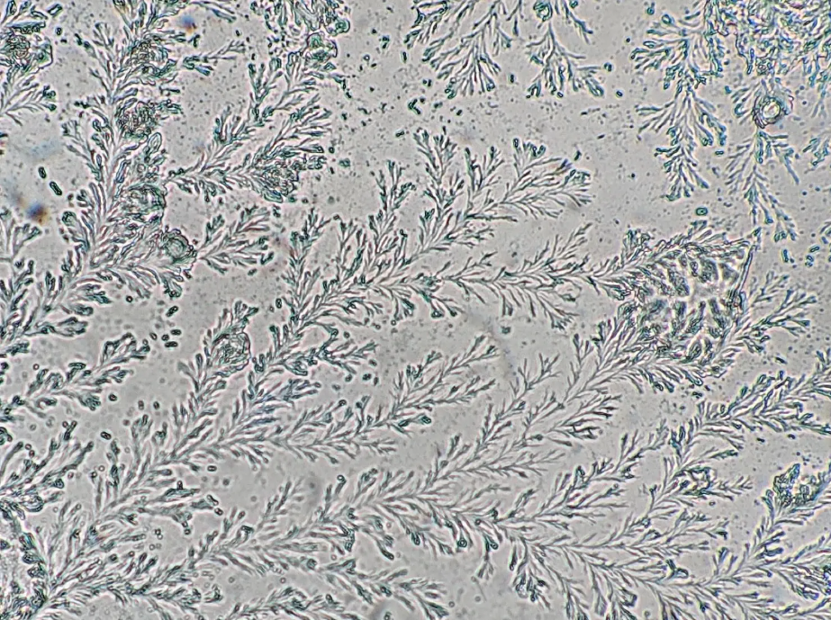 Fern Test, Ferning of the cervical fluid post rupture of membranes Credit: Your Cervical Mucus Is Beautiful https://www.sciencefriday.com/articles/cervical-mucus-health/